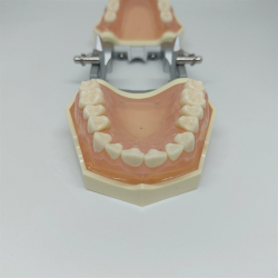 Studiemodel med Aftagelige Tnder 